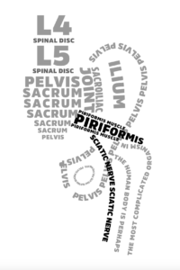 Sciatic back pain